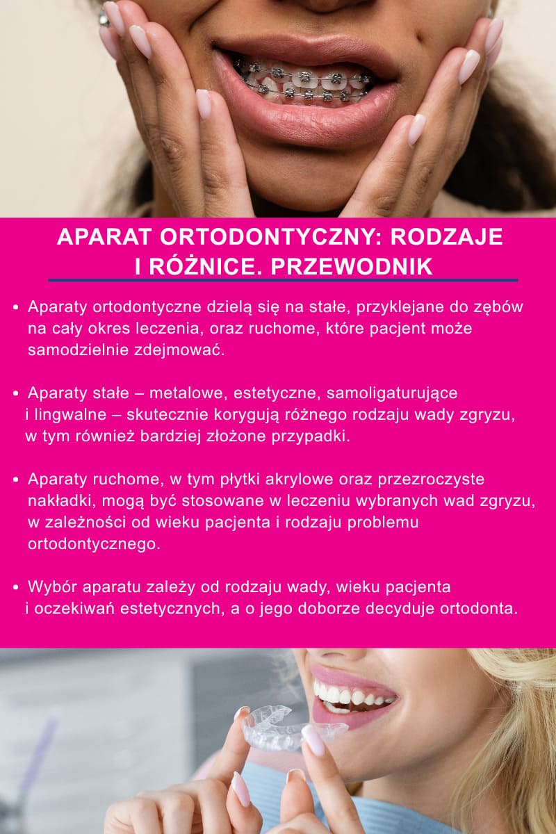 Aparat ortodontyczny: rodzaje i różnice. Przewodnik